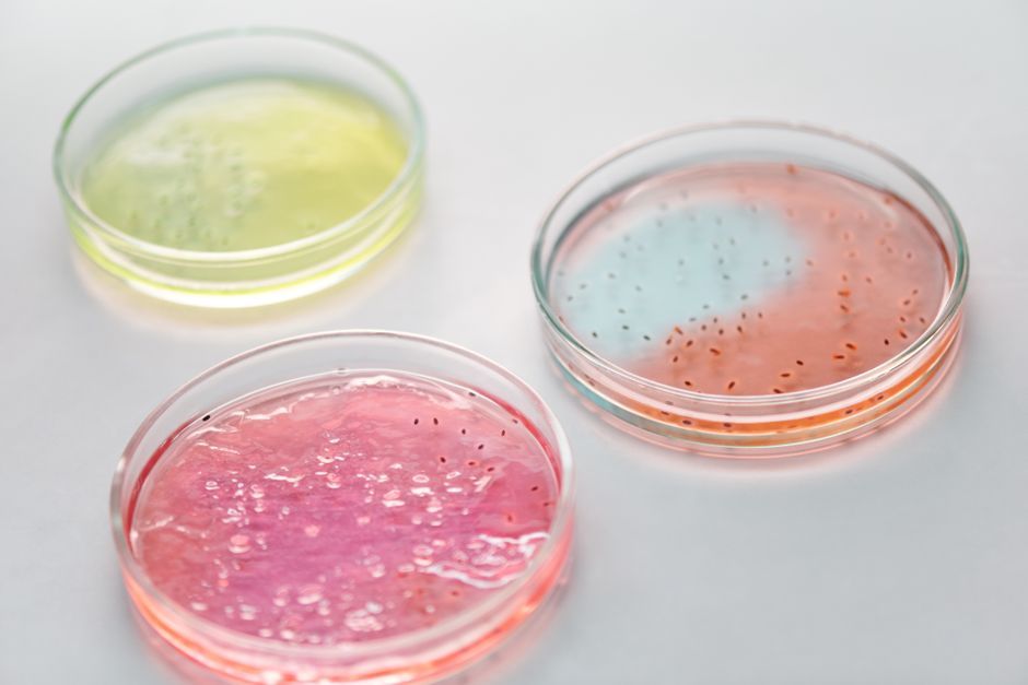 petri dish bacterial culture laboratory equipment