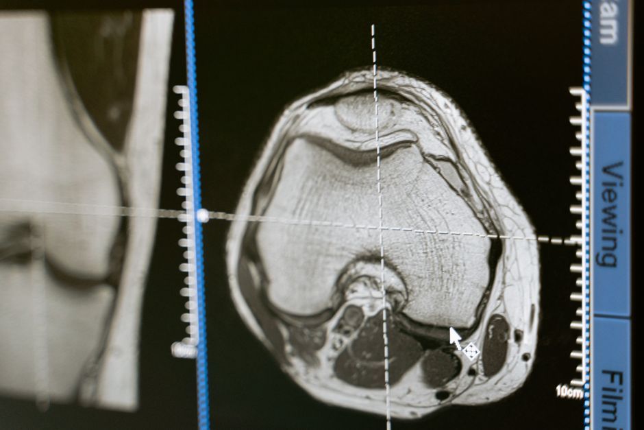 breast anatomy medical scan
