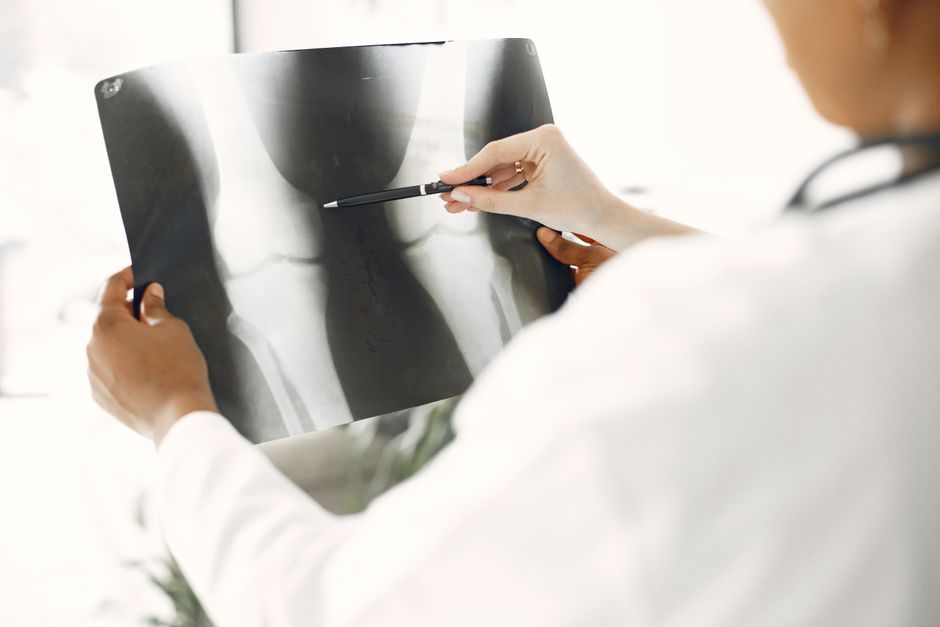 orthopedic doctor examining shoulder X-ray in hospital