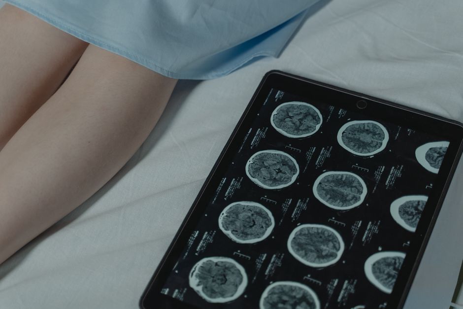 brain scan medical imaging screen